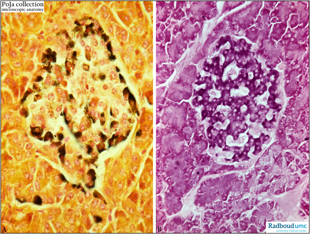 α And β Cells In Pancreatic Islet Of Langerhans Human Poja Collection Microscopic Anatomy
